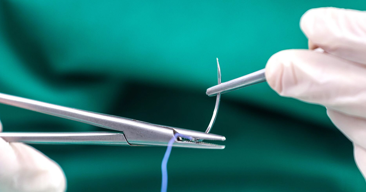 Mastering Suturing Techniques and Choosing the Right Materials in Dentistry