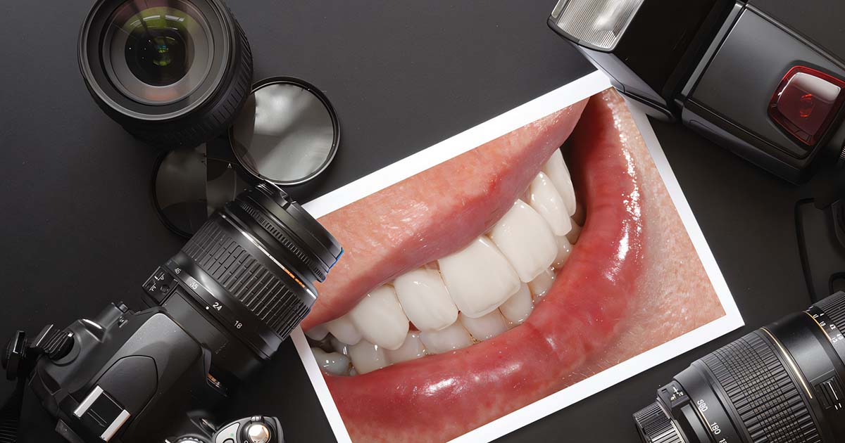 Dental Photography in 2025: The Ultimate Beginner’s Guide for Dentists