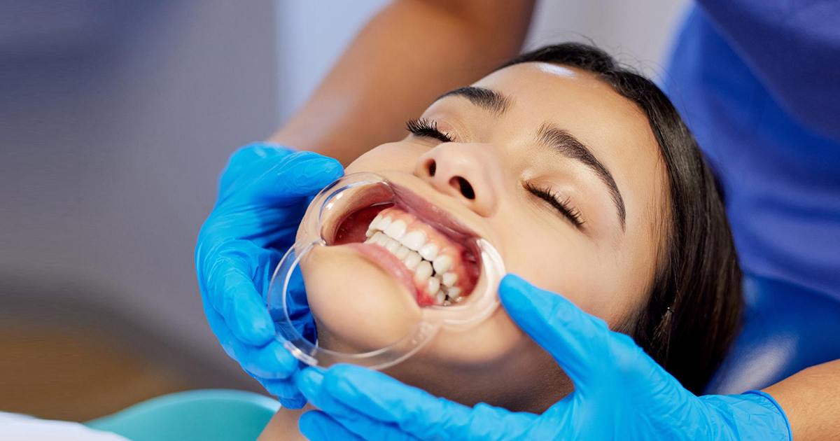 Cheek Retractors: Types, Benefits, and Common Mistakes to Avoid in Dental Practice 