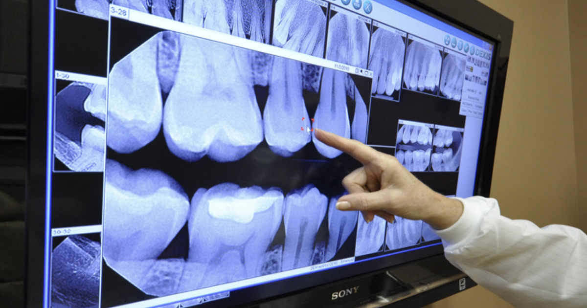 Digital Radiography: 8 Reasons It’s Worth the Transition 