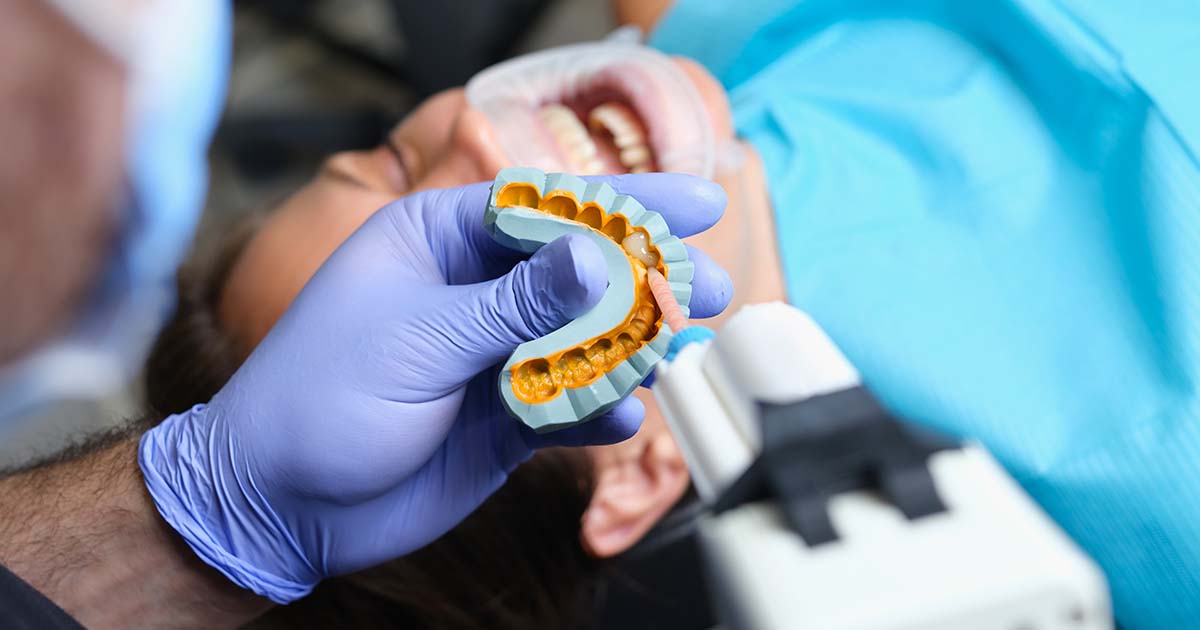 A Comprehensive Overview of Dental Impression Materials for Accurate Restorations