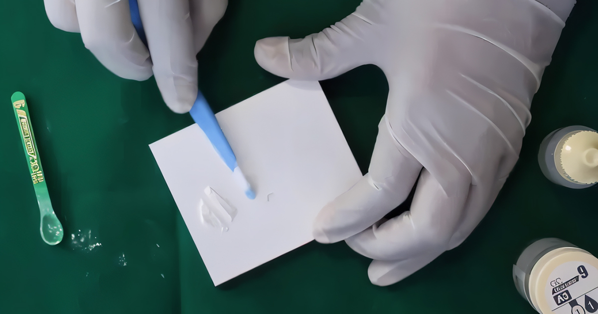 GIC in Dentistry: Comprehensive Overview of Types, Properties, and Modifications