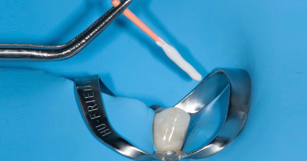 Emerging Bioceramic Materials in Endodontics: Benefits, Limitations, and Clinical Applications 