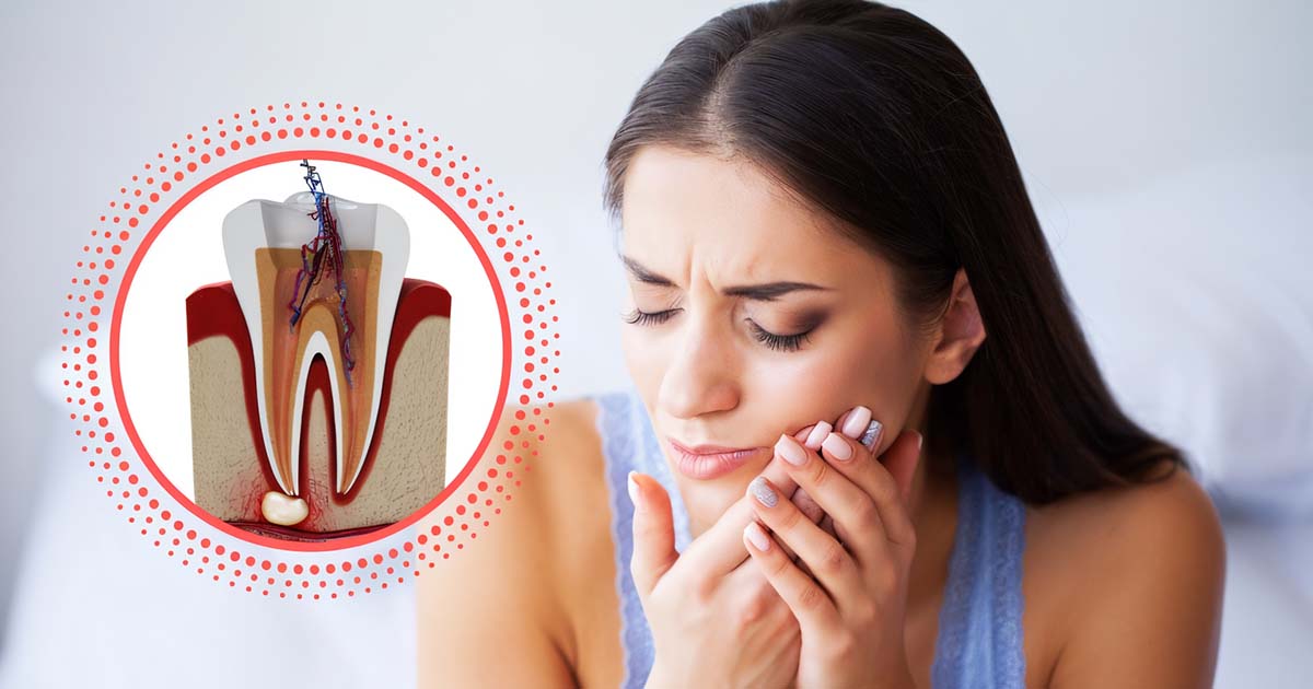 Managing Post-operative Pain After Root Canal Treatment: Best Practices