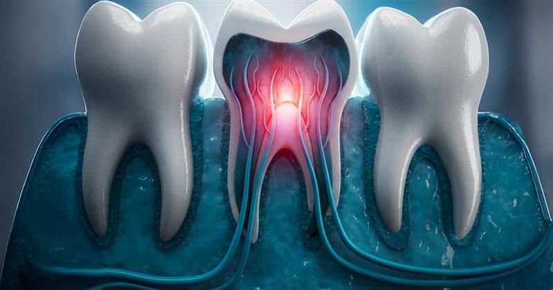 Managing Tooth HyperSensitivity: Diagnosis &amp; Treatment Options