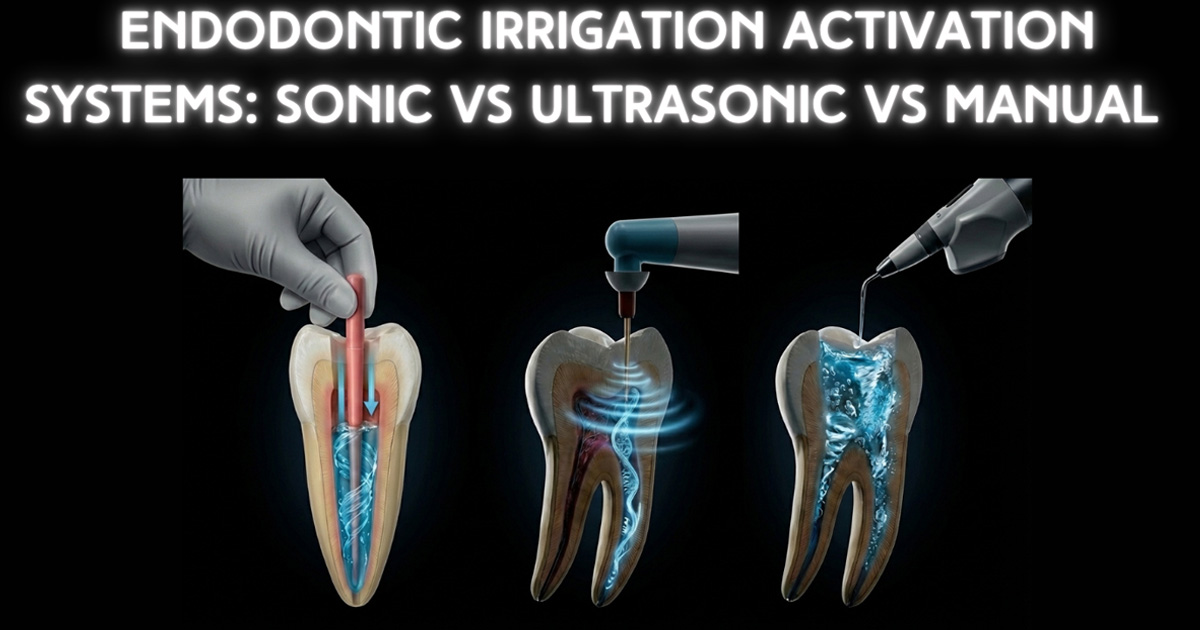 Endodontic Irrigation Activation Systems: Sonic vs Ultrasonic vs Manual