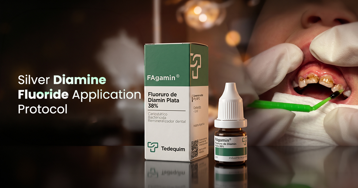 Silver Diamine Fluoride Application Protocol