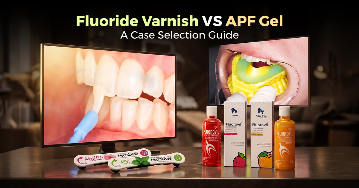 Fluoride Varnish vs. APF Gel: A Case Selection Guide