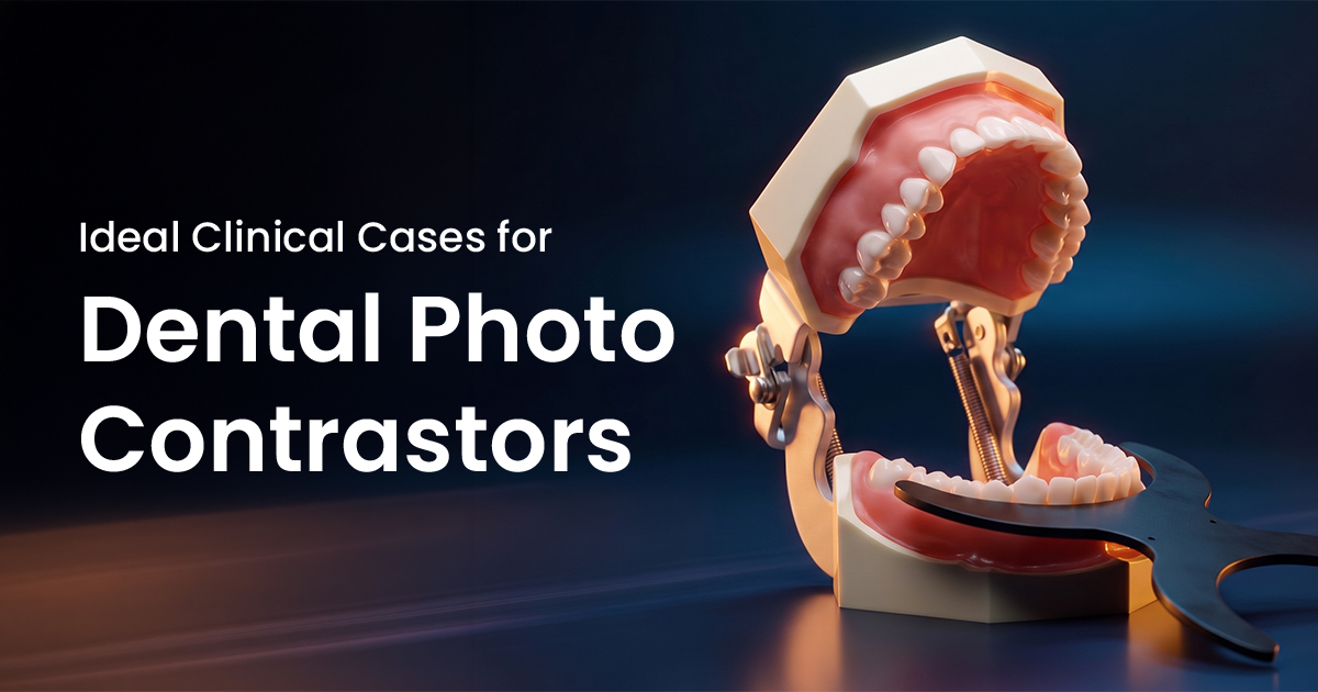 Ideal Clinical Cases for Dental Photo Contrastors