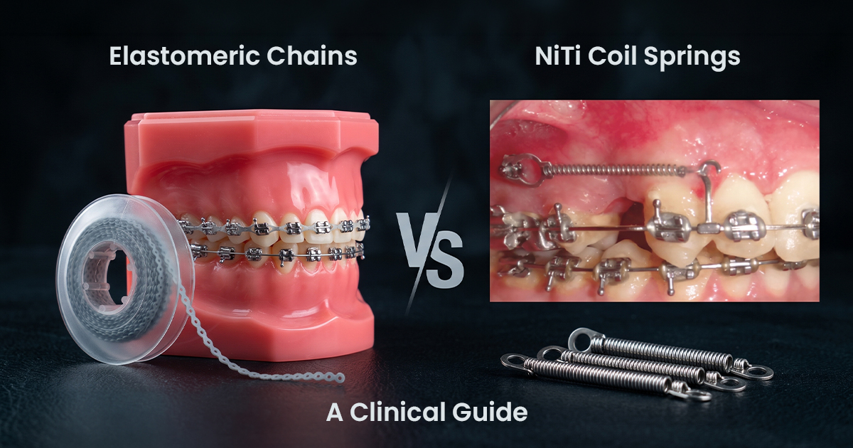 Elastomeric Chains vs. NiTi Coil Springs: A Clinical Guide