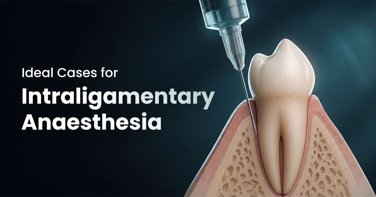 Ideal Cases for Intraligamentary Anaesthesia