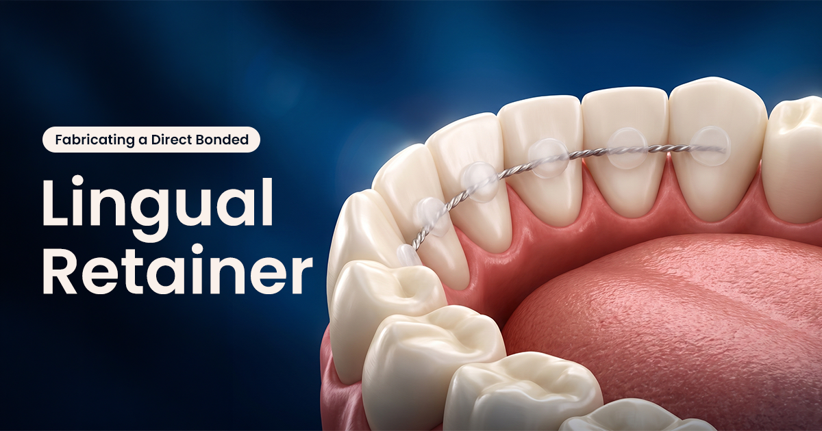 Fabricating a Direct Bonded Lingual Retainer