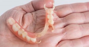 Dentures vs Implants - What to choose, Advantages and Disadvantages