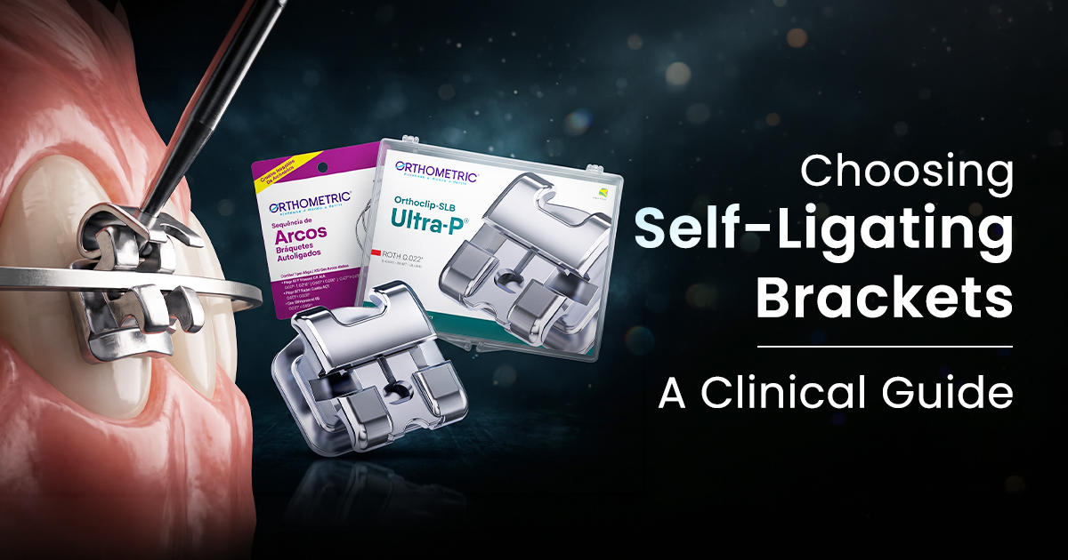 Choosing Self-Ligating Brackets: A Clinical Guide