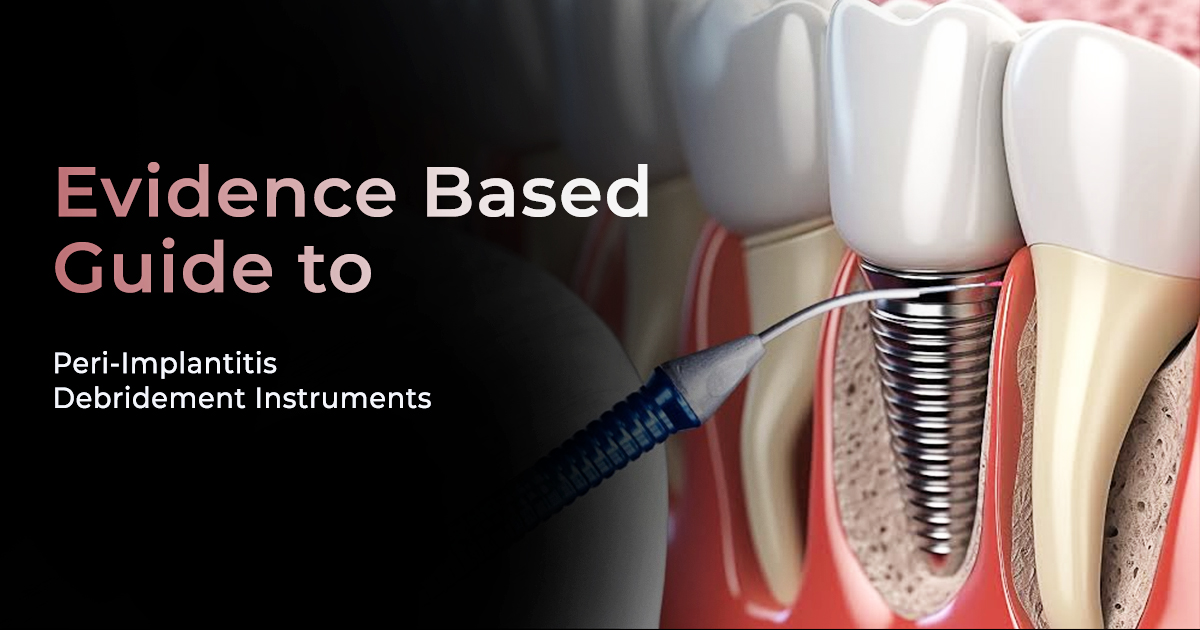 Evidence-Based Guide to Peri-Implantitis Debridement