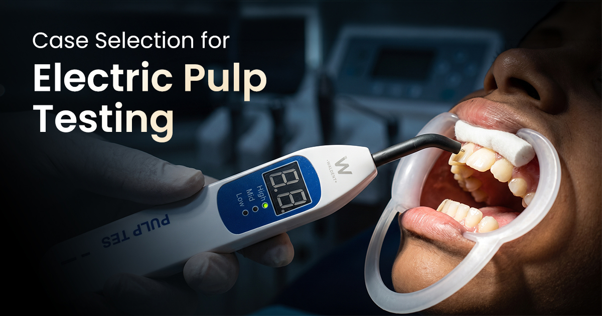 Case Selection for Electric Pulp Testing
