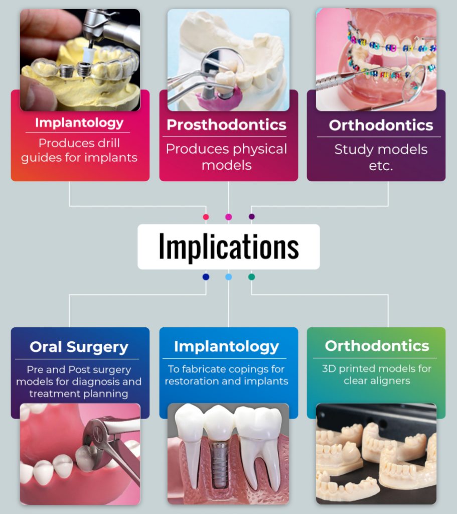 Major Implications of 3D Printing