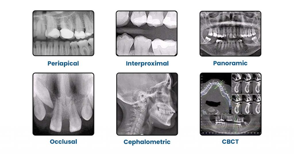 How to Read and Interpret Dental X-Rays: Beginner’s Guide for Students